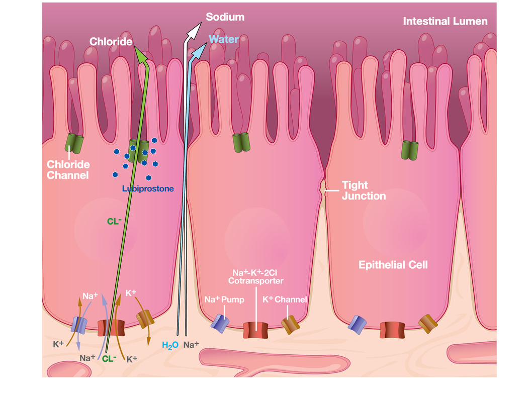 Constipation diagram